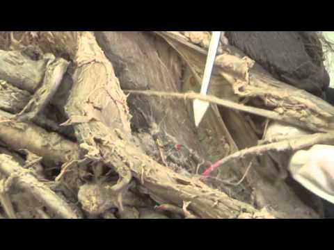 ◄╣ Muscles of the Front of the Thigh (Part 2) ╠►