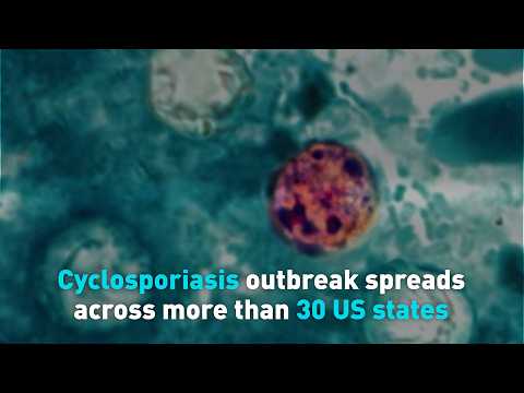 Cyclosporiasis outbreak spreads across more than 30 US states