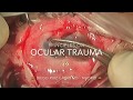 Ocular Trauma Principles