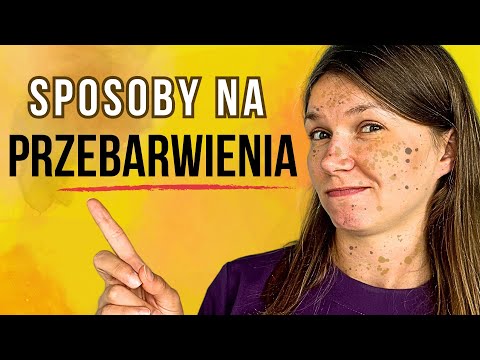 ⚡️Discoloration: Symptoms, CAUSES, Treatment | Ways to Remove Discoloration