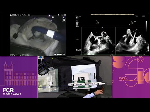 The EVOQUE and PASCAL Precision systems in action: simulation- and case-based learning