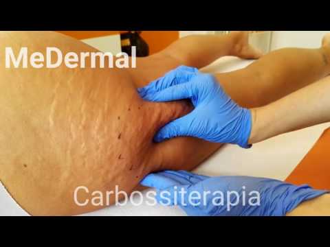 Mal di schiena tira lo stomaco durante la gravidanza Dolore nella respirazione petto e alla gola e difficoltà