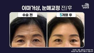 �̹̰Ż�, ���ű��� ��/��