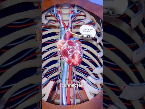 How A Pacemaker Works 🤔
