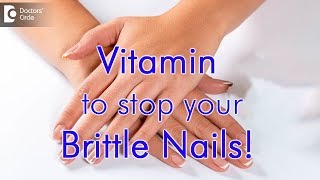 What Vitamin are you lacking when you have brittle nails? - Dr. Priya J Talageri