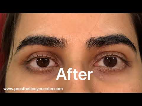 Artificial eye movements