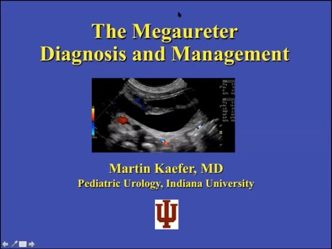 8.11.2020 PedsUroFLO Lecture - The Megaureter: Diagnosis and Management