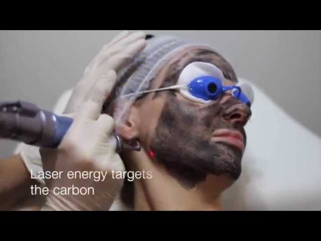 Youtube - M-Laser Knokke