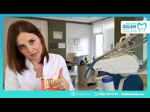 İmplant Tedavisi Nedir? İmplant Tedavisi Nasıl Yapılır? - Diş Hekimi Özlem Özcan