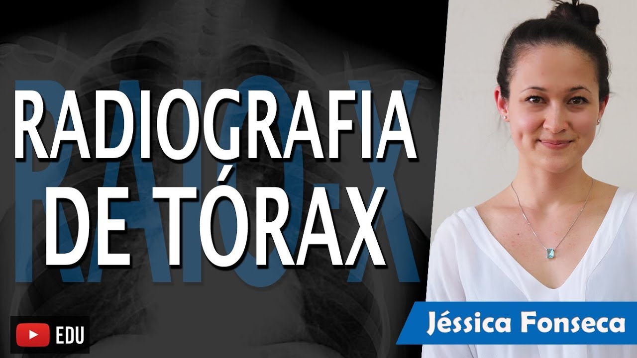 RAIO-X DE TÓRAX (Aula de Radiografia) - Jéssica Fonseca