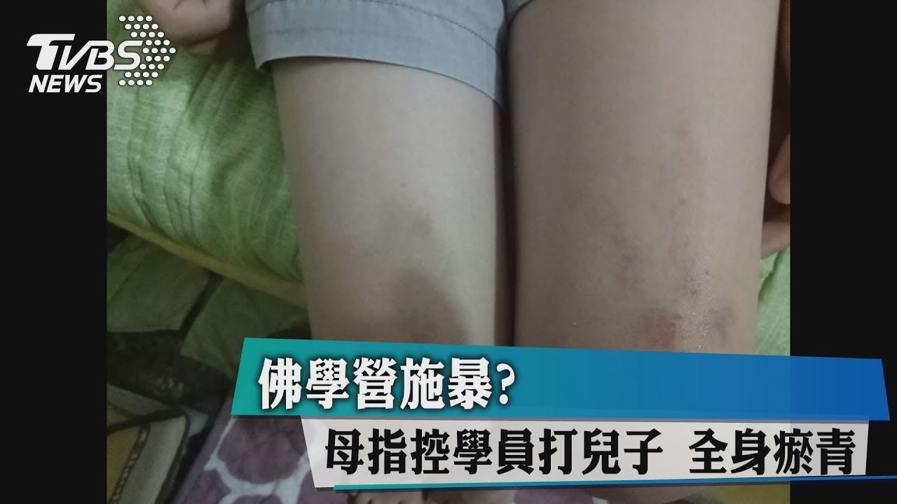 佛學營施暴？母指控學員打兒子　全身瘀青