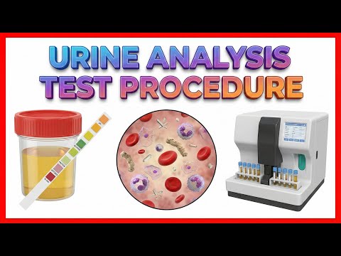 Urine analysis test procedure : Biochemistry Practicals