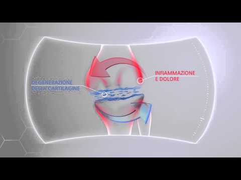 Mal di sinistra dellombelico e le mani nella parte posteriore Con cui mettere Milgamma dellosteocondrosi