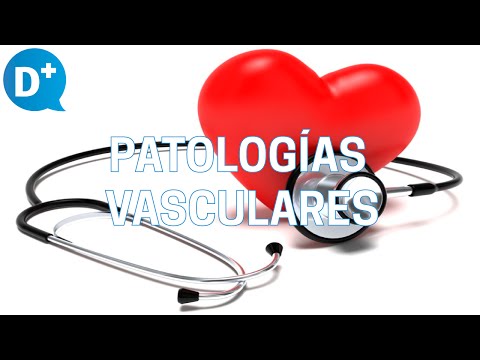Patologías vasculares más comunes