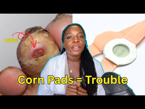 The Hidden Dangers of Corn & Callus Remover Pads | Dr. Tarr