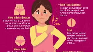 Download lagu Keluhan setelah jalani operasi caesar mp3