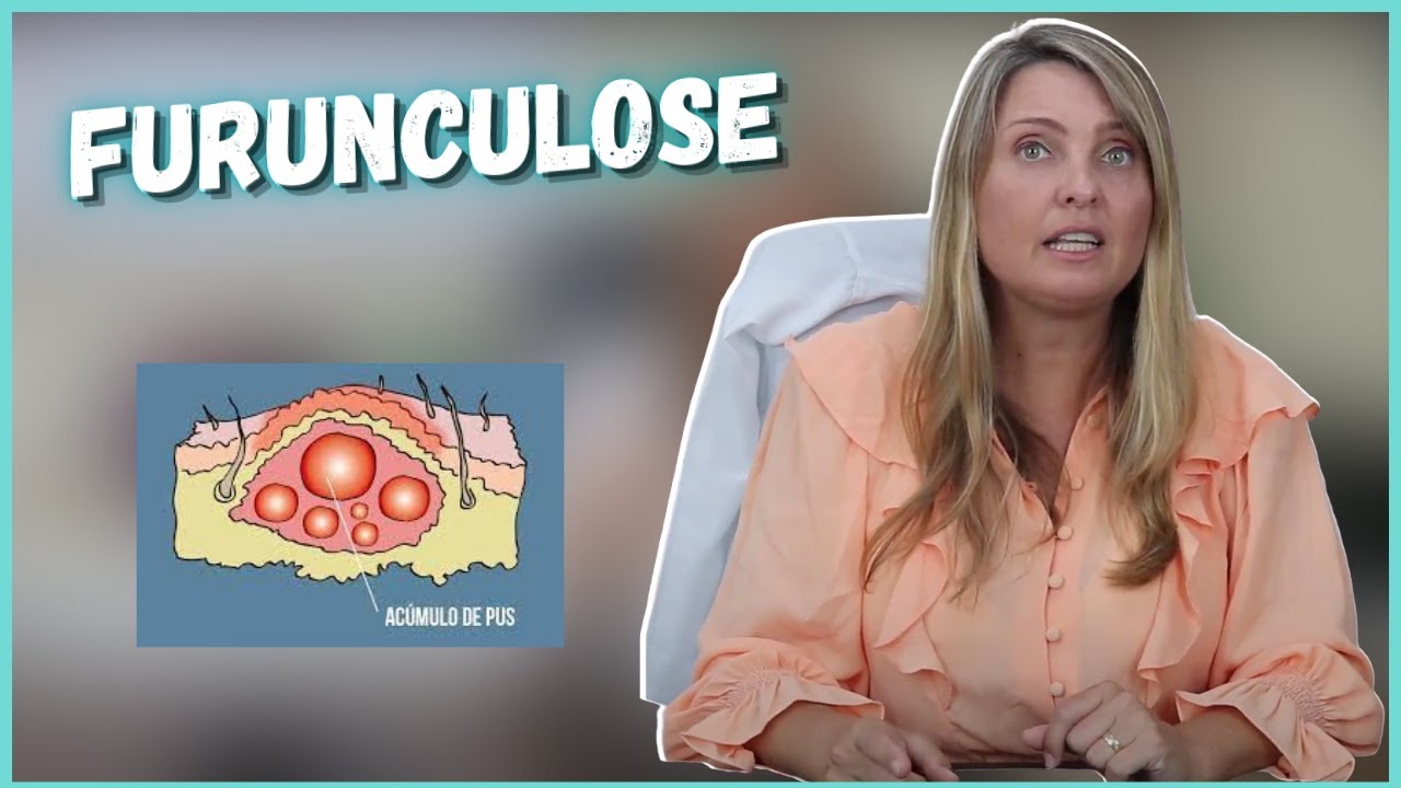 DICA DO DIA - FURUNCULOSE - @draelizetekaffer
