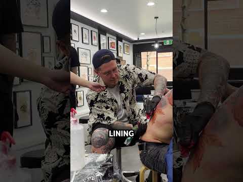 Does lining or shading hurt more?