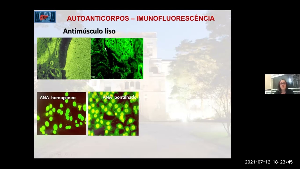 Aula Hepatite auto-imune 2021
