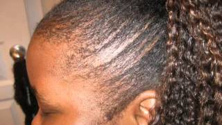 WOW!!! WE GREW OUR EDGES BACK!! 8-)  UPDATE / Jamaican Black CO