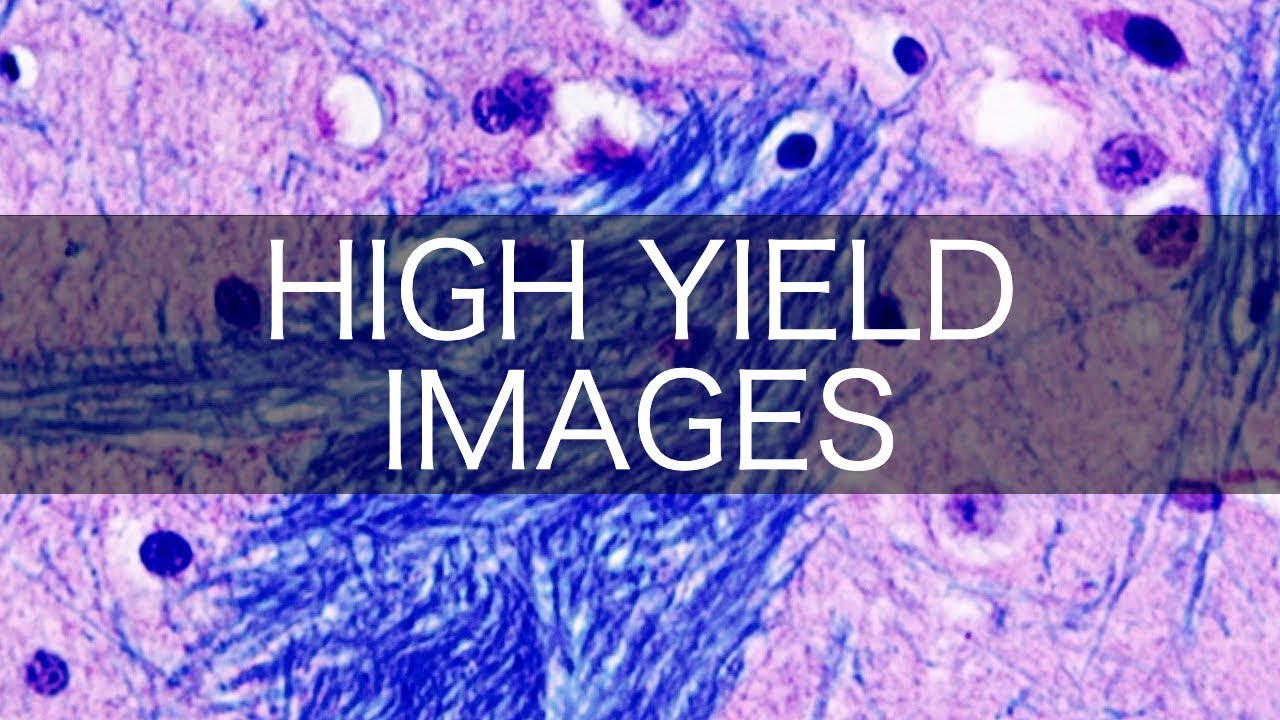 High Yield USMLE/COMLEX Images (pt. 8)