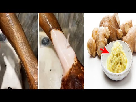 Eclaircir la peau rapidement avec le gingembre! 100% efficace et rapide, peau claire, gingembre peau