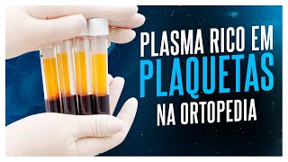 VOCÊ SABE O QUE É PLASMA RICO EM PLAQUETAS (PRP)?