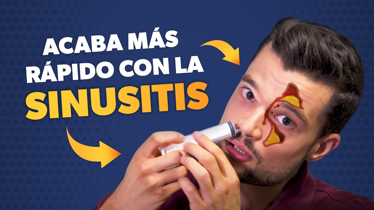 Cómo curar la SINUSITIS más rápido
