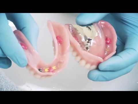 Zahnprothesen  – Korrekte Anwendung von Haftcreme