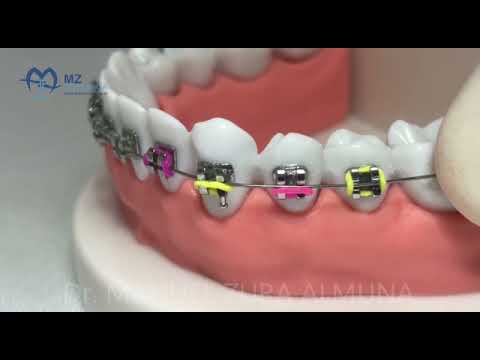 Urgencias en ortodoncia