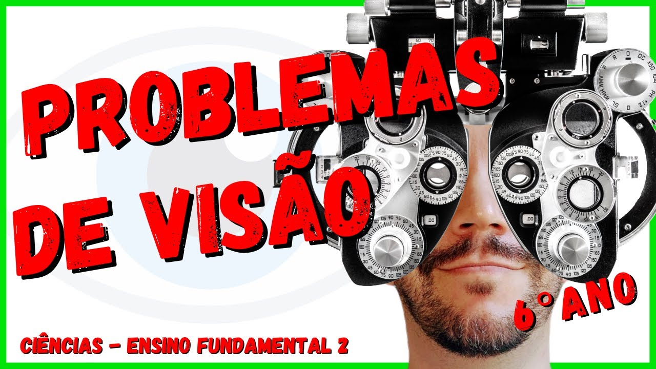 Problemas de visão - Lentes corretivas | Ciências 6° ano | Aula completa com resumo 2022