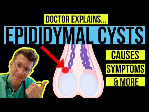 Doctor explains TESTICULAR LUMPS: PART 1 - EPIDIDYMAL CYSTS (causes, symptoms and treatments)