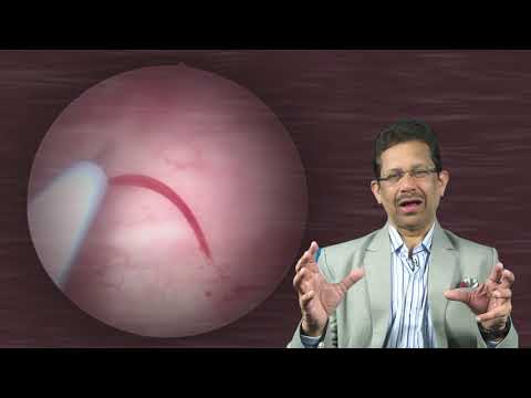 Refractory overactive bladder is treatable : NO TO DIAPERS AFTER YES TO BOTULINUM TOXIN THERAPY