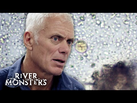 INVISIBLE KILLERS: Jeremy Wade's Trip To Hospital | River Monsters