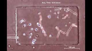 Microfluidic Arenas: Human neutrophils (blue) vs. Aspergillus fumigatus (red)