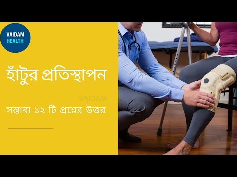 সম্পূর্ণ হাঁটু প্রতিস্থাপন- প্রায়শই জিজ্ঞাসিত প্রশ্ন