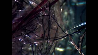 You WISH Morgellons Wasn't Real! (I Do Too)