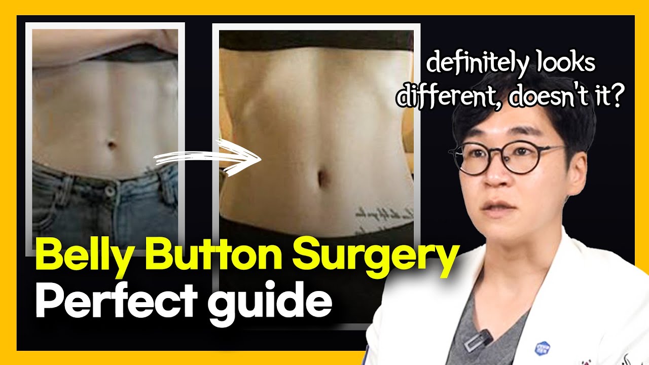 Belly Button Surgery Perfect Guide
