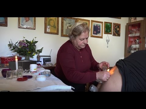 Medicina. cura di alcolismo Violazione di circolazione del sangue di alcolismo