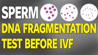Sperm DNA Fragmentation Test Before IVF // Dr. Richika Sahay Shukla