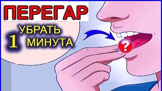 ПЕРЕГАР - КАК БЫСТРО ИЗБАВИТЬСЯ ОТ ЗАПАХА (13 способов)