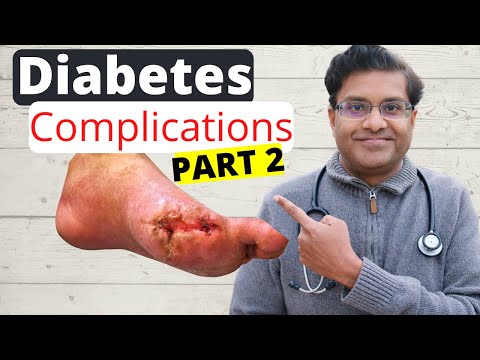 Most common COMPLICATIONS of uncontrolled diabetes: Screening & Evaluation| Doctor explains