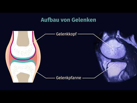 Gelenke – Bau und Typen einfach erklärt | sofatutor