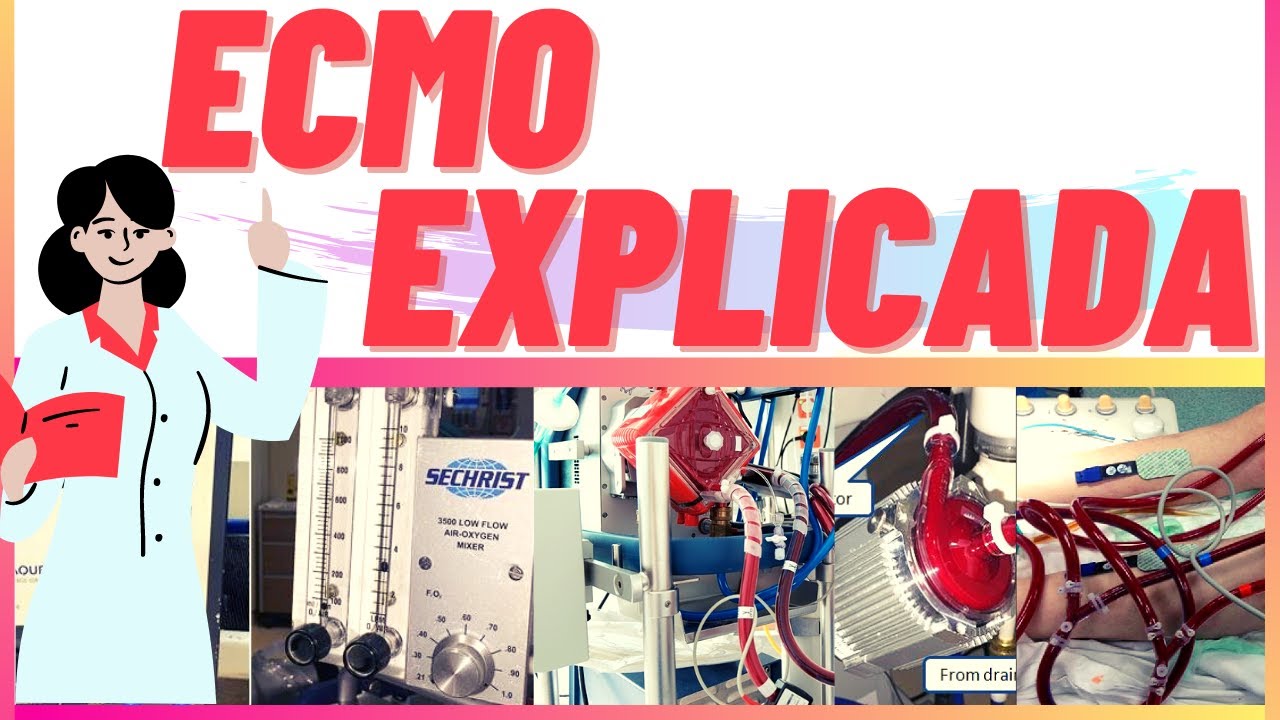CIRCUITO DE ECMO EXPLICADO