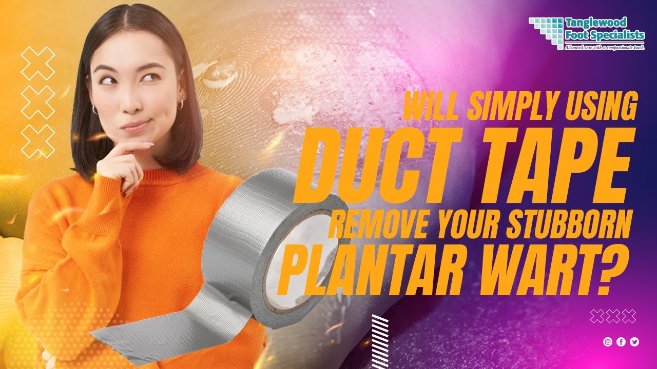 Will Simply Using Duct Tape Remove Your Stubborn Plantar Wart?