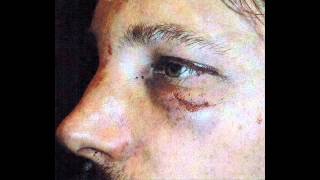 Halle Berry's busted ex-boyfriend Gabriel Aubry: I'm the victim in fight with Olivier Martinez