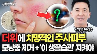 주사피부, 치료할 수 있습니다! 모낭충 제거와 악화 막는 생활습관