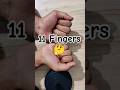 11 Fingers Under Count Fingers Counting Trick Reels Magic Tricks Shorts