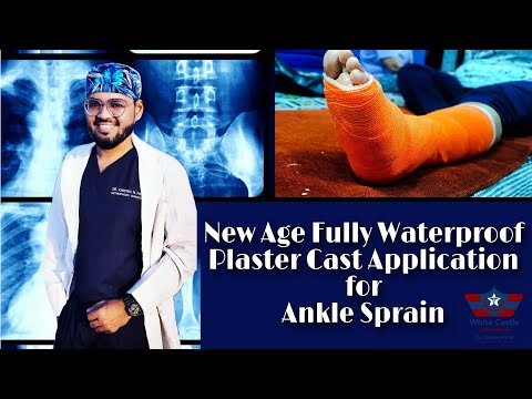 New Age Fully Waterproof Plaster Cast Application for Ankle Sprain | Orthopaedic Story | Dr Chintan