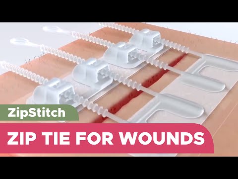 When you can't Stitch it, Zip it: Suture-Less bandage to close wounds